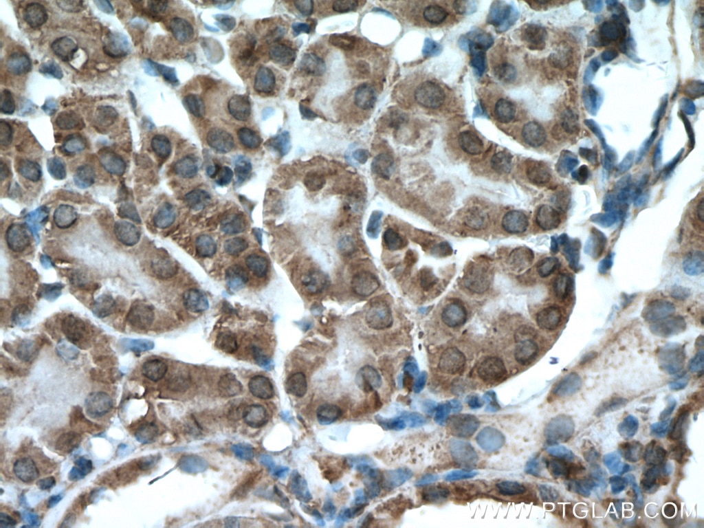 Immunohistochemistry (IHC) staining of mouse kidney tissue using XYLT1 Polyclonal antibody (55061-1-AP)