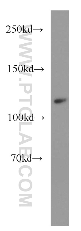 Western Blot (WB) analysis of BxPC-3 cells using XYLT1 Polyclonal antibody (55061-1-AP)