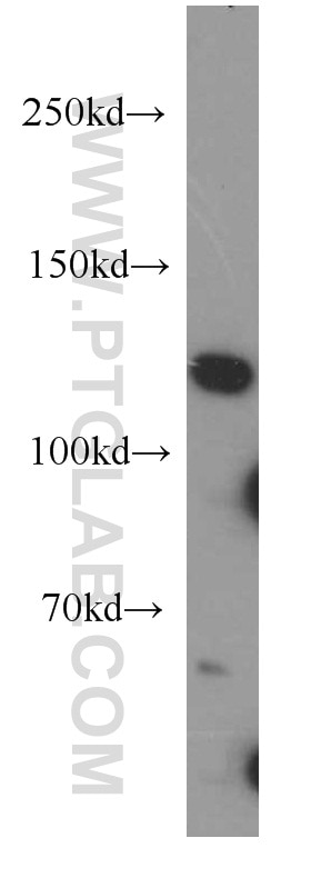 Western Blot (WB) analysis of HEK-293 cells using XYLT1 Polyclonal antibody (55061-1-AP)