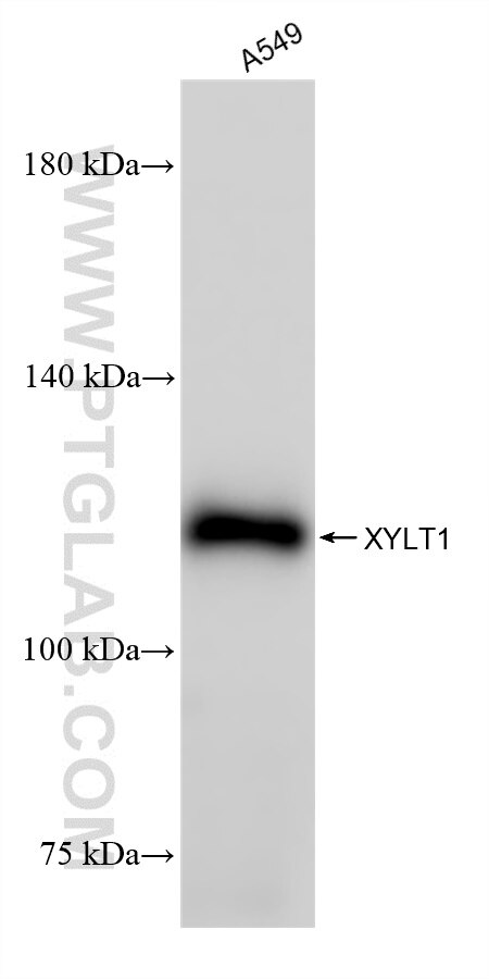 Western Blot (WB) analysis of various lysates using XYLT1 Recombinant antibody (85008-1-RR)