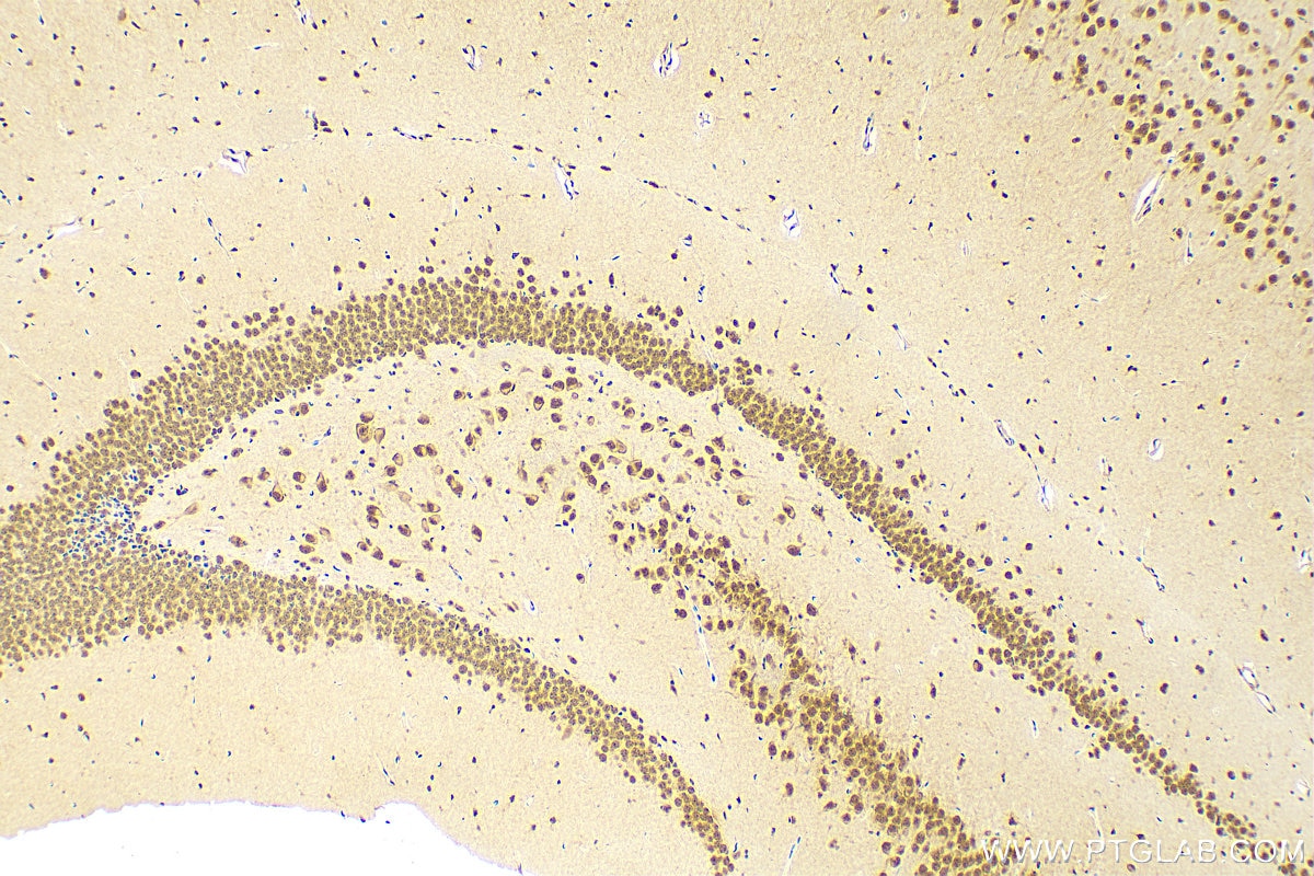 Immunohistochemistry (IHC) staining of mouse brain tissue using YAF2 Polyclonal antibody (13980-1-AP)