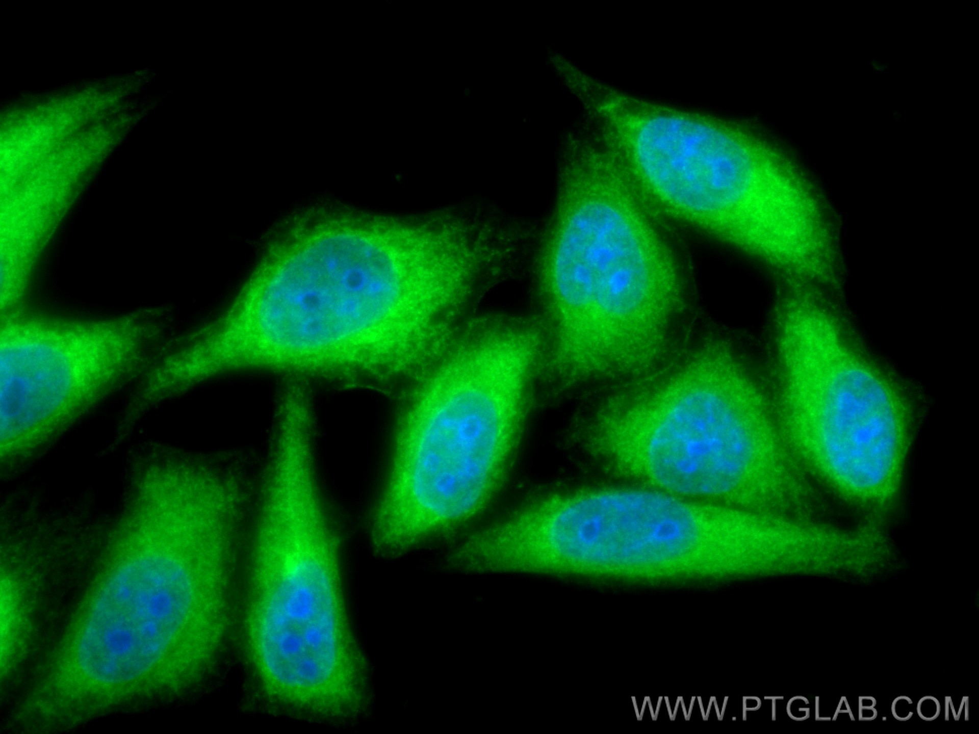 Immunofluorescence (IF) / fluorescent staining of HepG2 cells using YAP1 Polyclonal antibody (13584-1-AP)