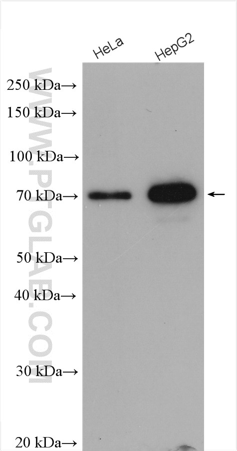 Western Blot (WB) analysis of various lysates using YAP1 Polyclonal antibody (13584-1-AP)