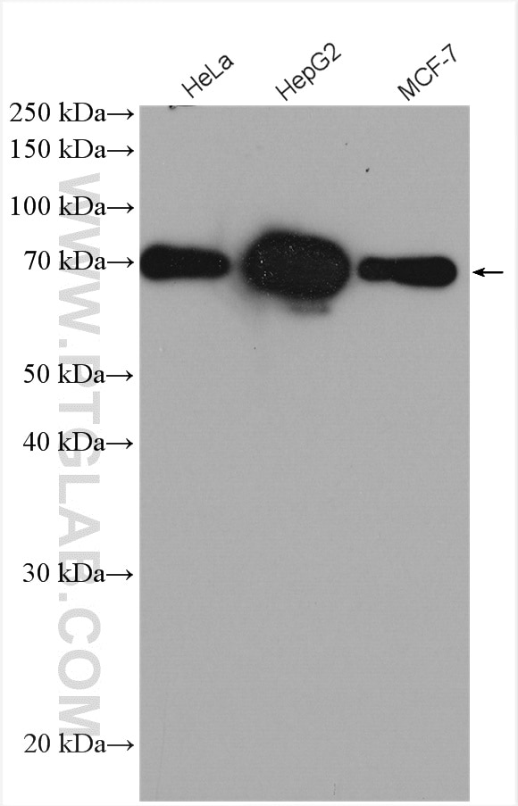 Western Blot (WB) analysis of various lysates using YAP1 Polyclonal antibody (13584-1-AP)