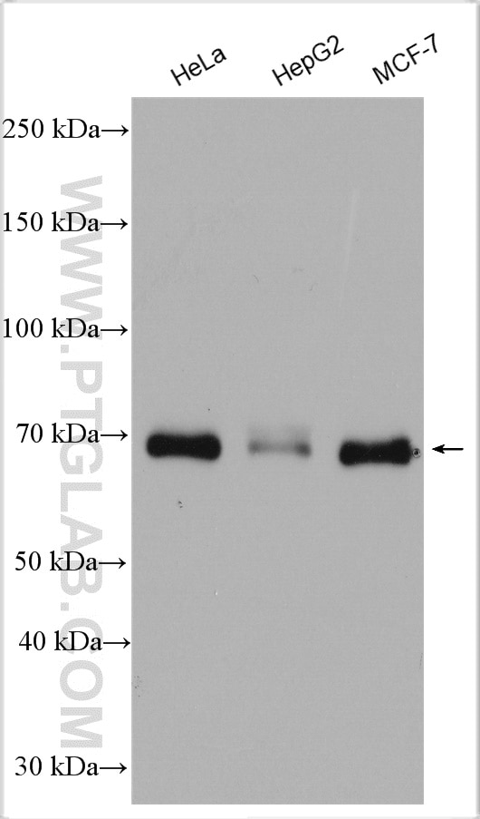 Western Blot (WB) analysis of various lysates using YAP1 Polyclonal antibody (13584-1-AP)