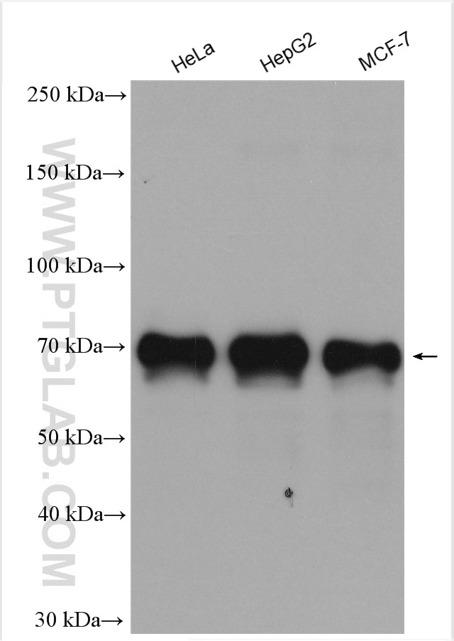 Western Blot (WB) analysis of various lysates using YAP1 Polyclonal antibody (13584-1-AP)