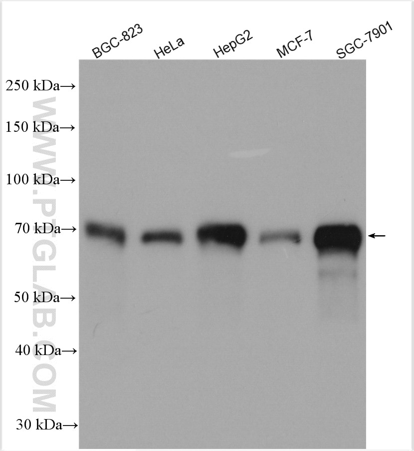 Western Blot (WB) analysis of various lysates using YAP1 Polyclonal antibody (13584-1-AP)