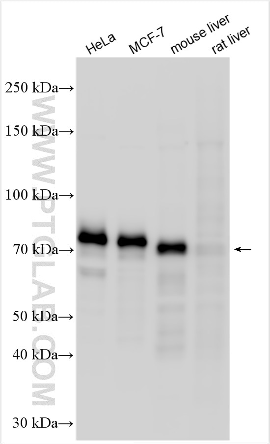 Western Blot (WB) analysis of various lysates using YAP1 Polyclonal antibody (13584-1-AP)