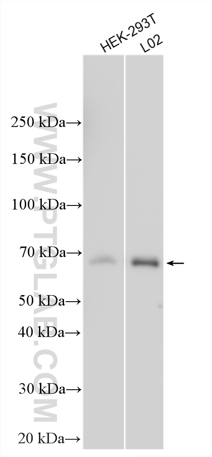 Western Blot (WB) analysis of various lysates using YAP1 Polyclonal antibody (13584-1-AP)