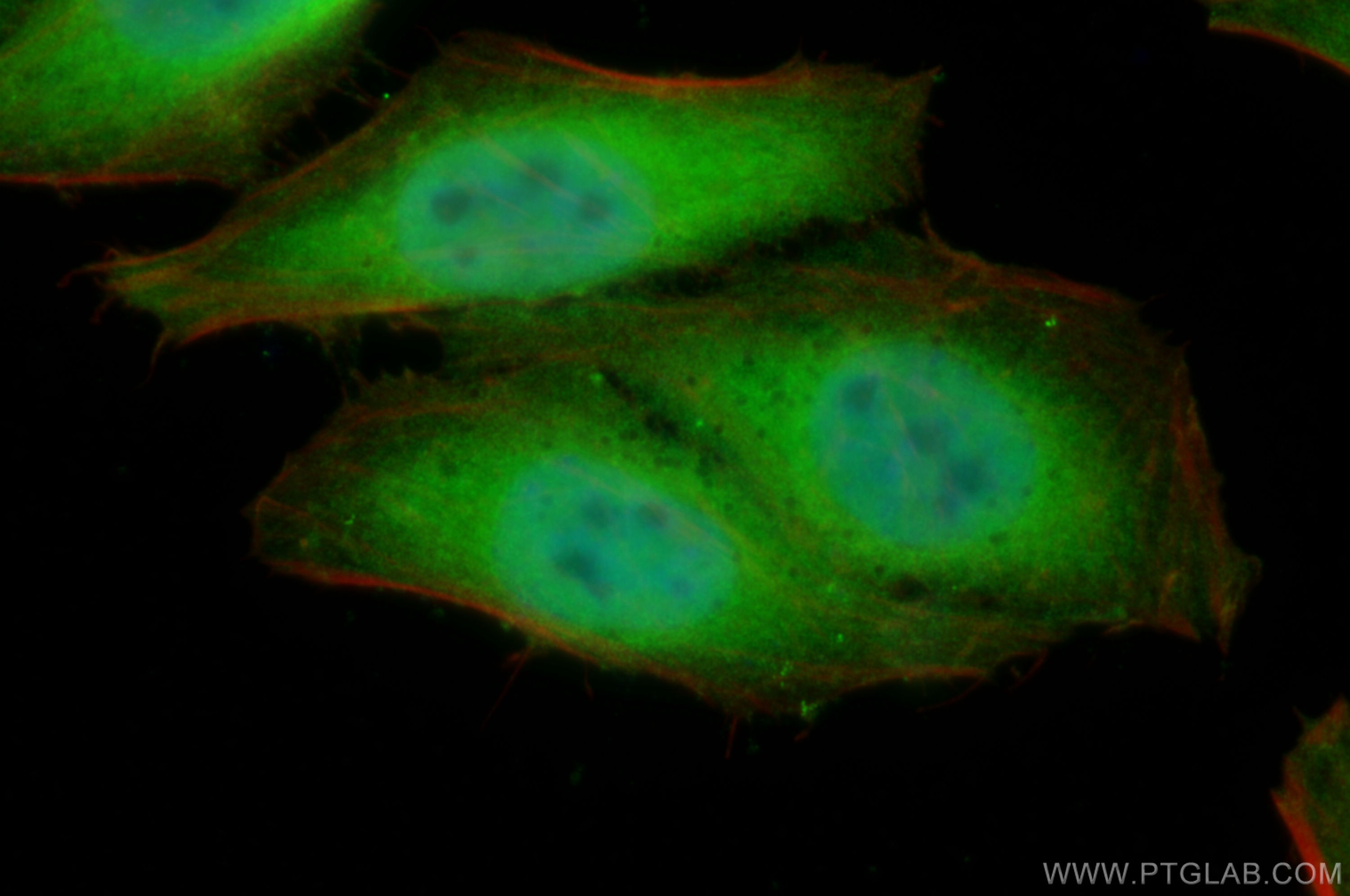 Immunofluorescence (IF) / fluorescent staining of HepG2 cells using YAP1 Polyclonal antibody (30464-1-AP)
