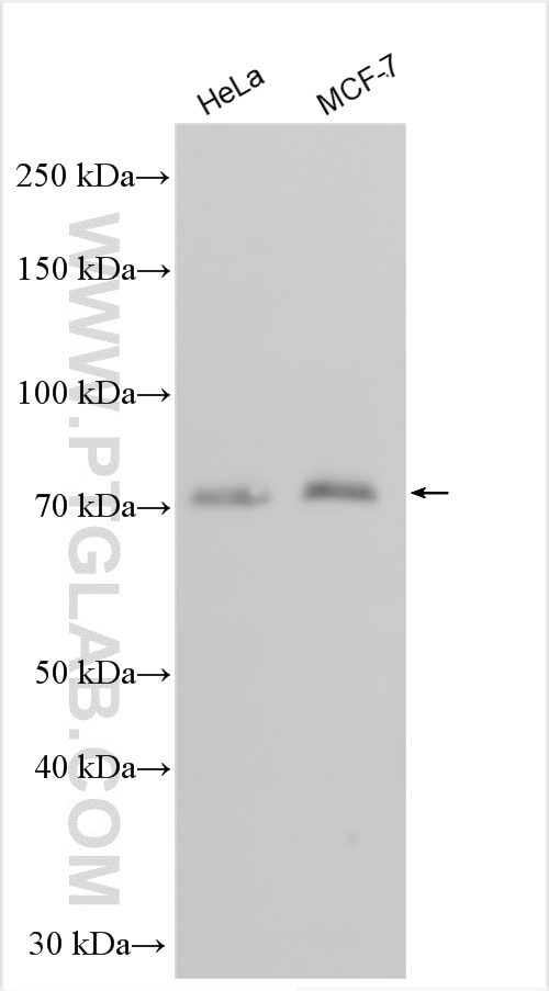 Western Blot (WB) analysis of various lysates using YAP1 Polyclonal antibody (30464-1-AP)