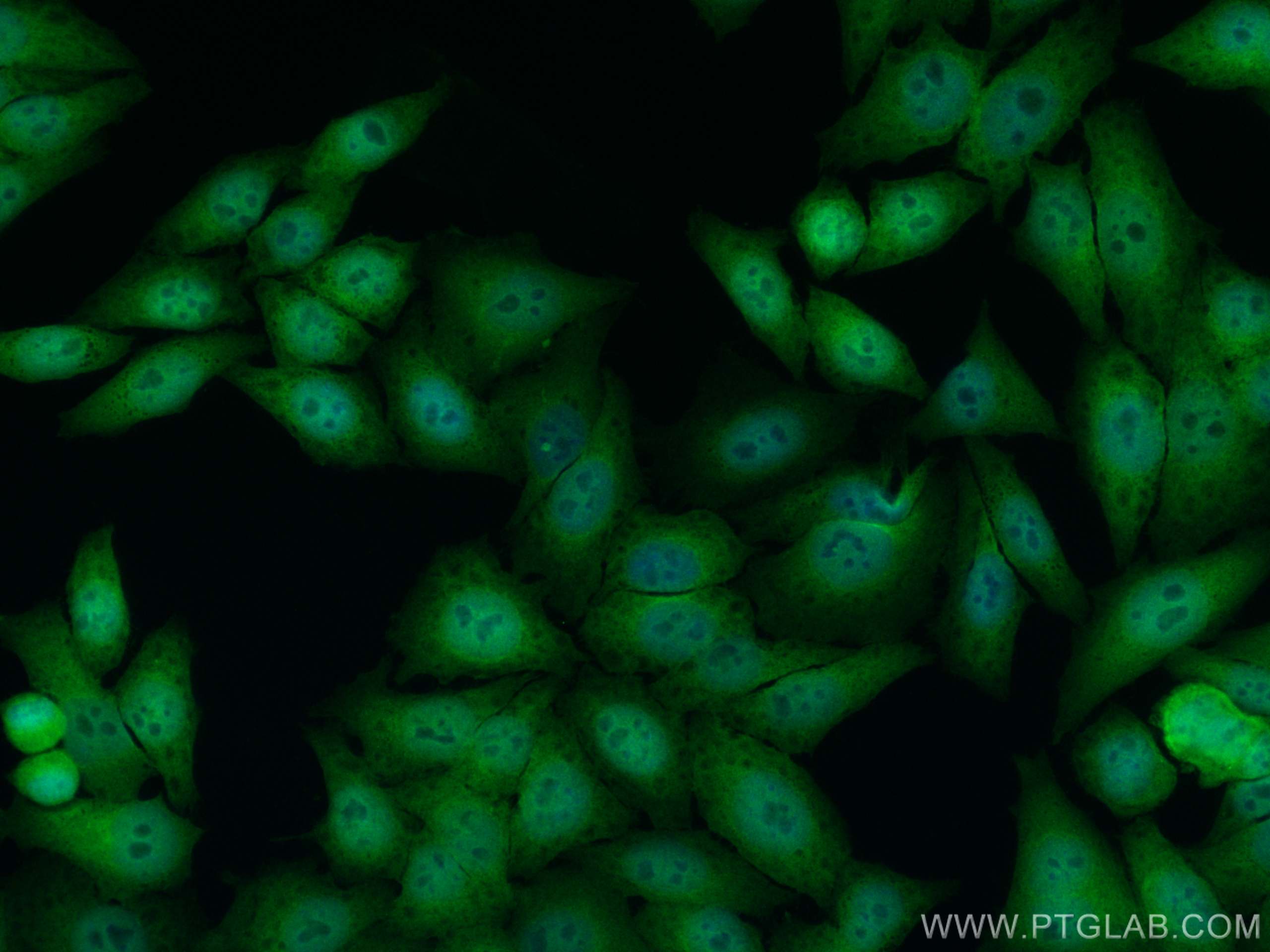 Immunofluorescence (IF) / fluorescent staining of HepG2 cells using YAP1 Recombinant antibody (81090-1-RR)