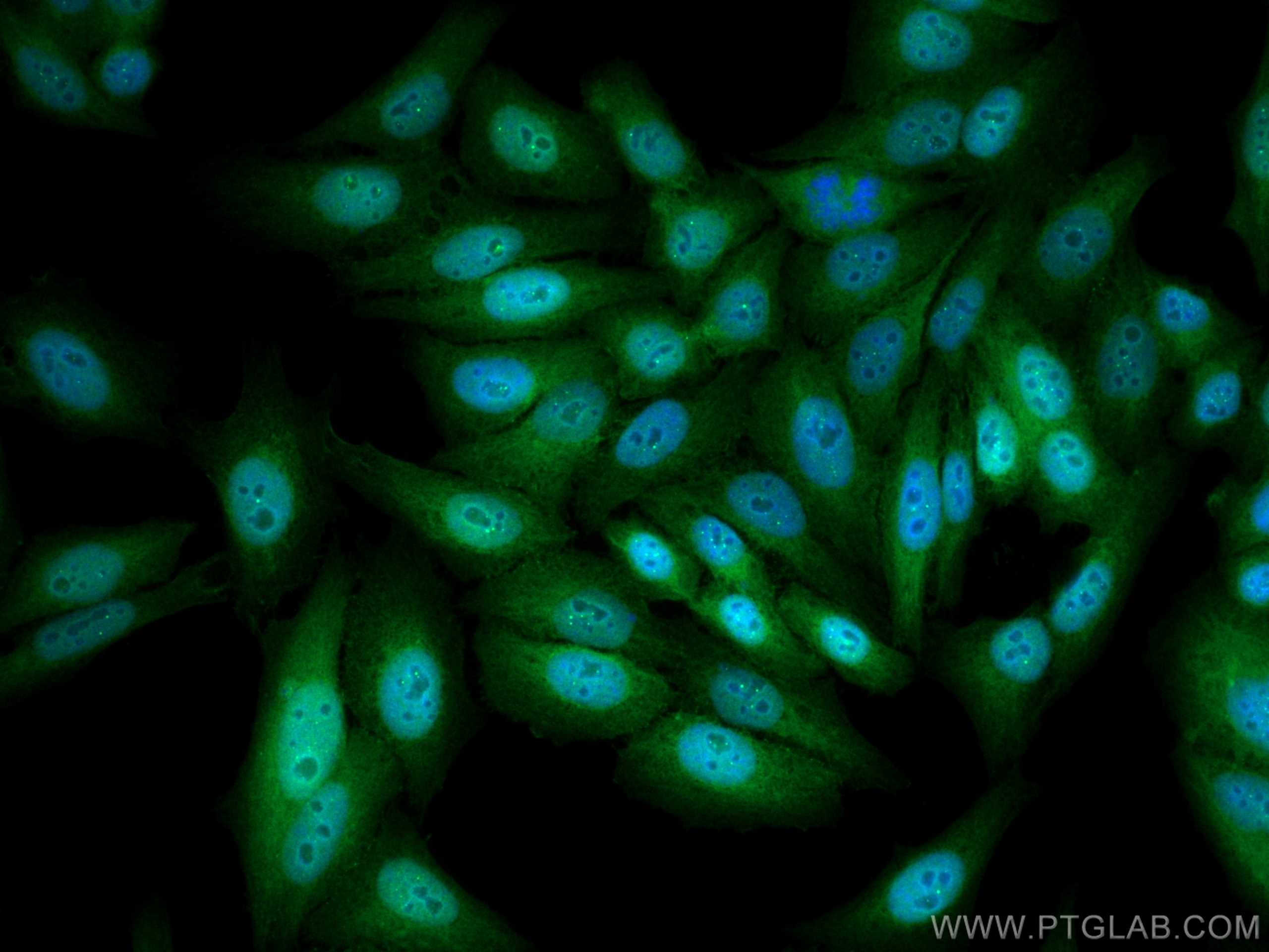 Immunofluorescence (IF) / fluorescent staining of HepG2 cells using CoraLite® Plus 488-conjugated YAP1 Polyclonal anti (CL488-13584)