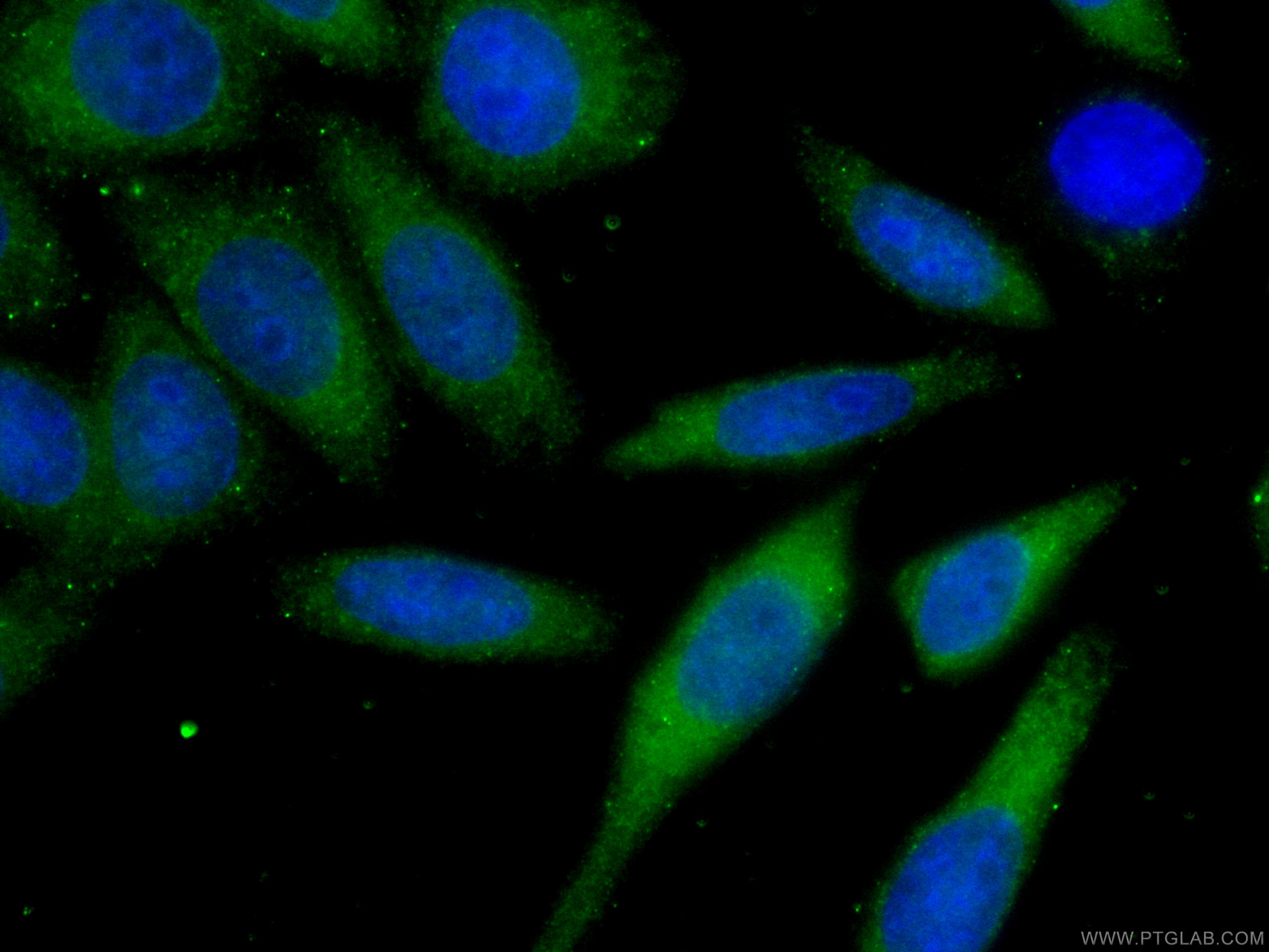 Immunofluorescence (IF) / fluorescent staining of HepG2 cells using CoraLite® Plus 488-conjugated YAP1 Monoclonal anti (CL488-66900)