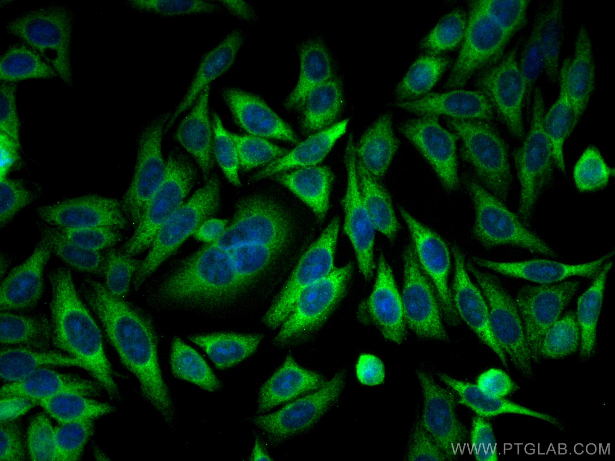 Immunofluorescence (IF) / fluorescent staining of HepG2 cells using CoraLite® Plus 488-conjugated YAP1 Monoclonal anti (CL488-66900)