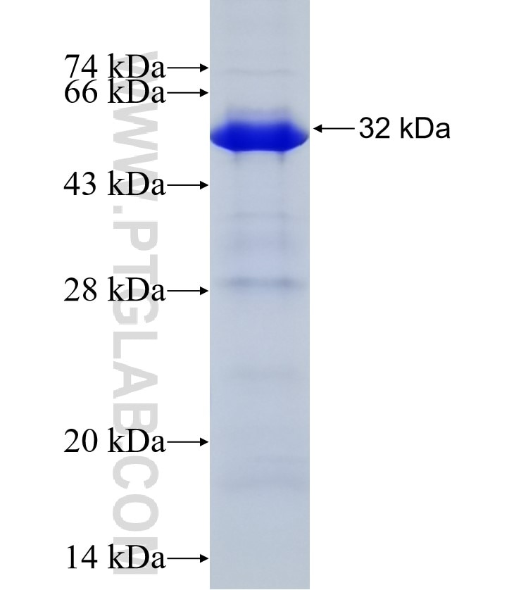 YAP1 fusion protein Ag28194 SDS-PAGE