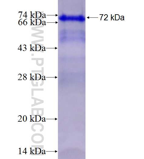 YAP1 fusion protein Ag4510 SDS-PAGE
