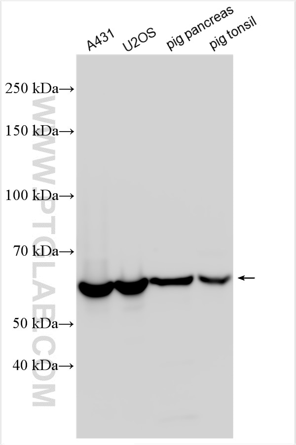Western Blot (WB) analysis of various lysates using YARS Polyclonal antibody (31228-1-AP)