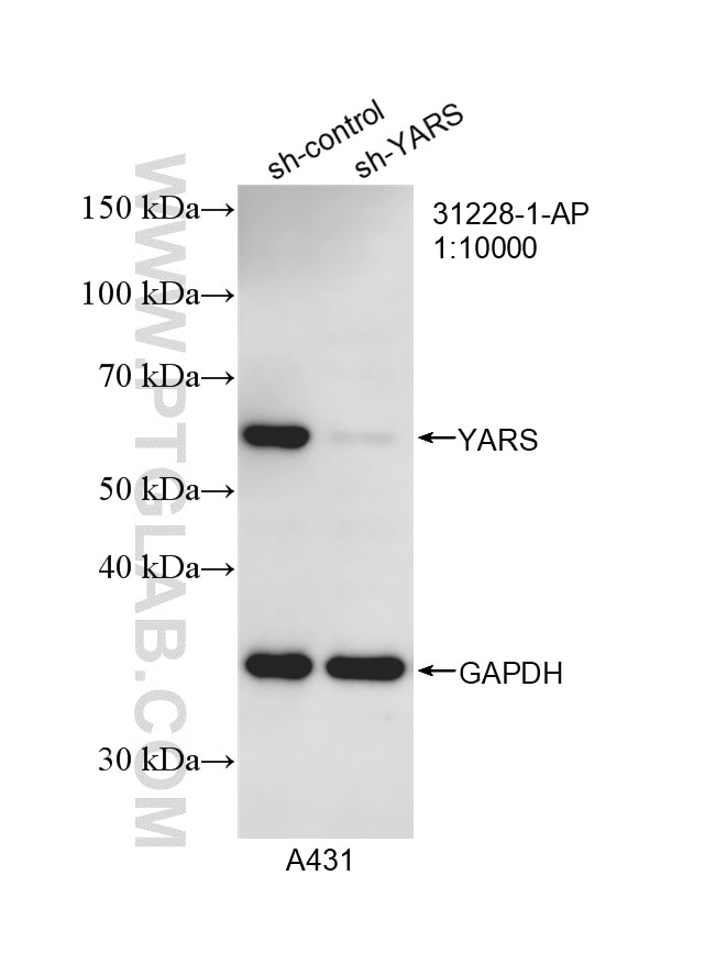 Western Blot (WB) analysis of A431 cells using YARS Polyclonal antibody (31228-1-AP)