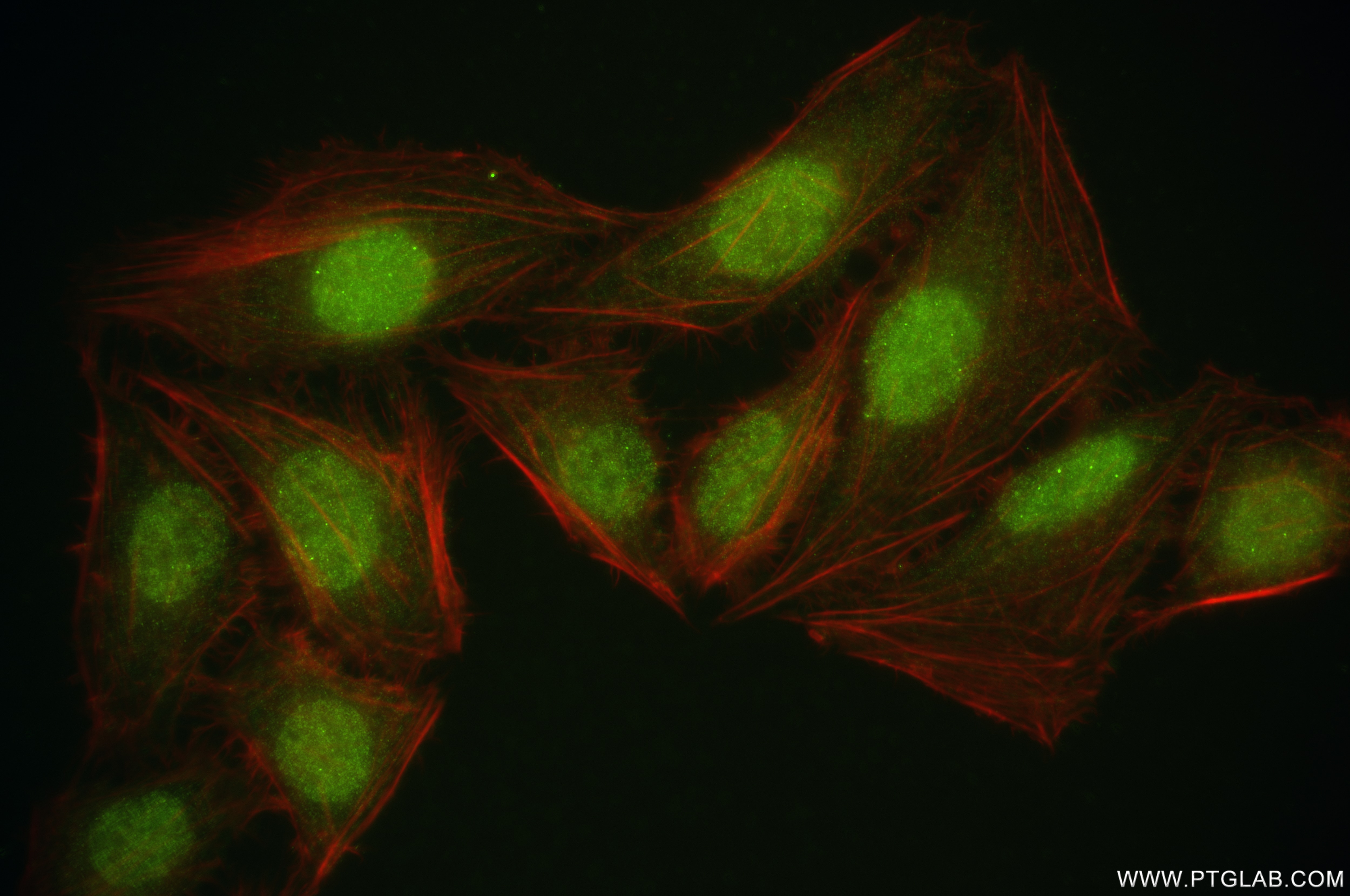 Immunofluorescence (IF) / fluorescent staining of U2OS cells using YARS Recombinant antibody (84859-3-RR)