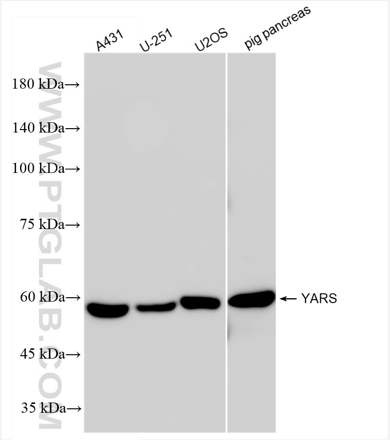 Western Blot (WB) analysis of various lysates using YARS Recombinant antibody (84859-3-RR)