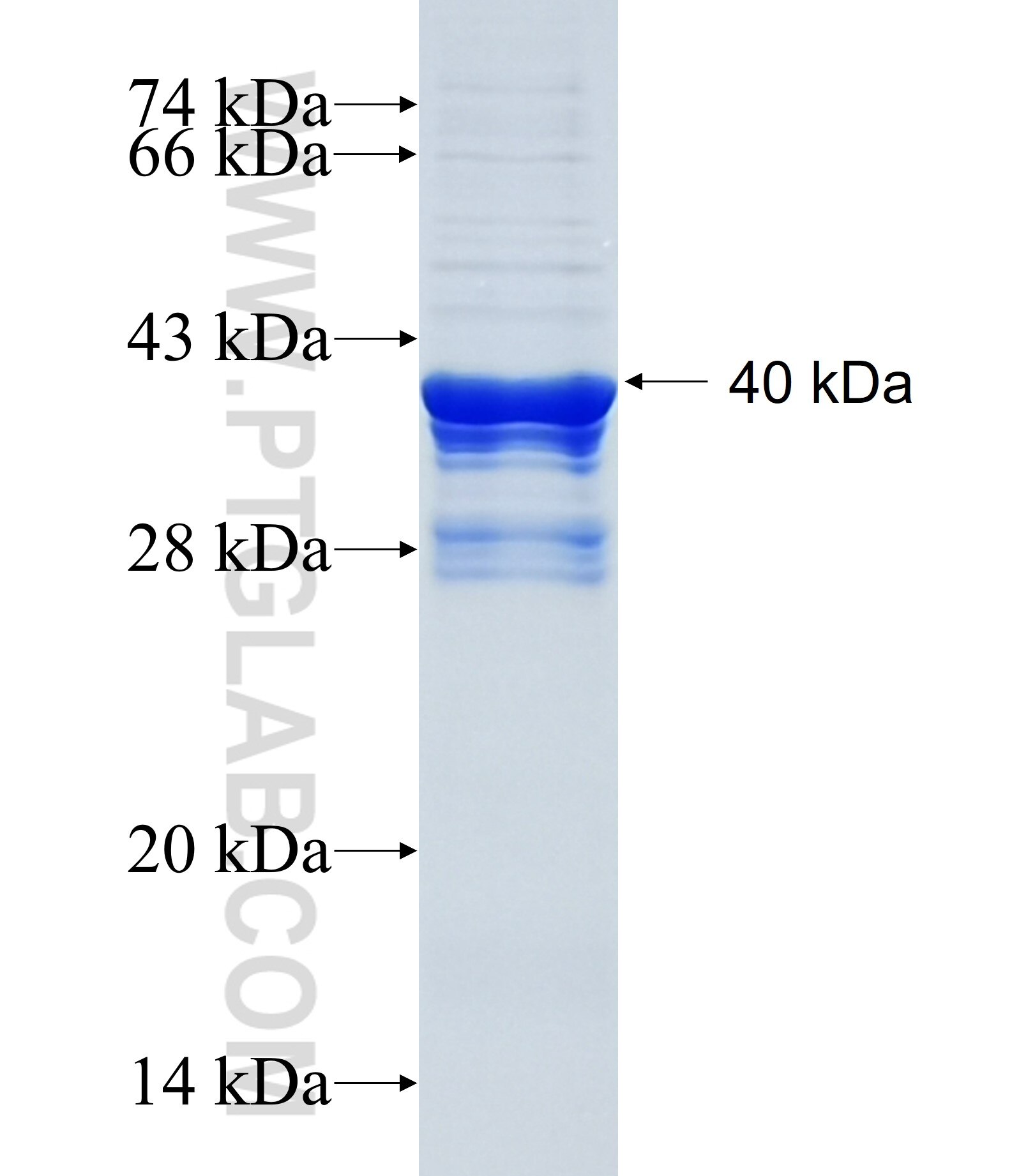 YARS fusion protein Ag35148 SDS-PAGE