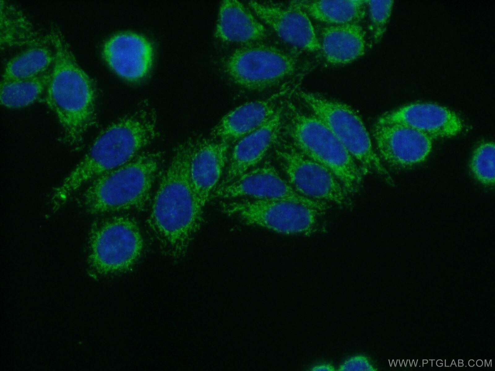 IF Staining of HepG2 using 17150-1-AP