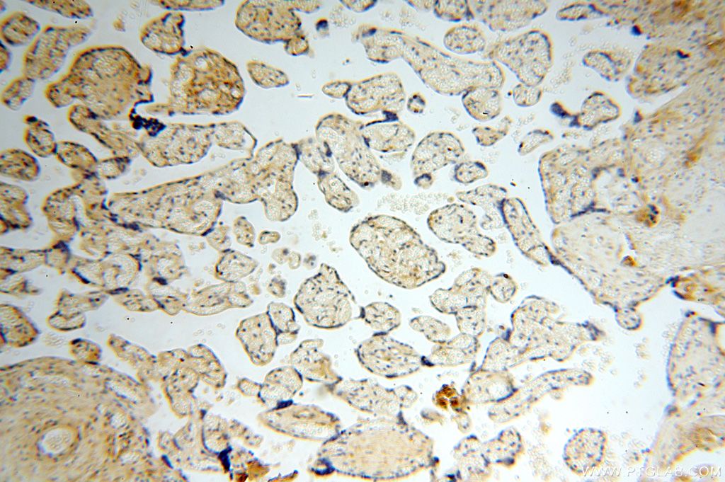 IHC staining of human placenta using 17150-1-AP