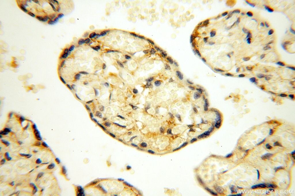 Immunohistochemistry (IHC) staining of human placenta tissue using YARS2 Polyclonal antibody (17150-1-AP)