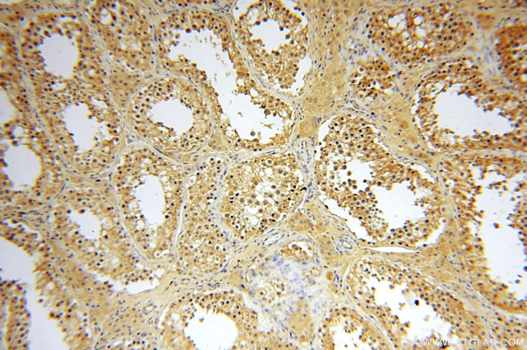 IHC staining of human testis using 17150-1-AP