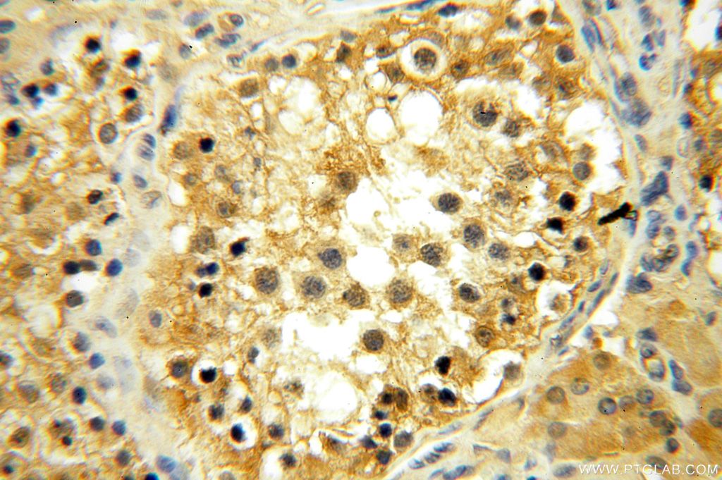 Immunohistochemistry (IHC) staining of human testis tissue using YARS2 Polyclonal antibody (17150-1-AP)