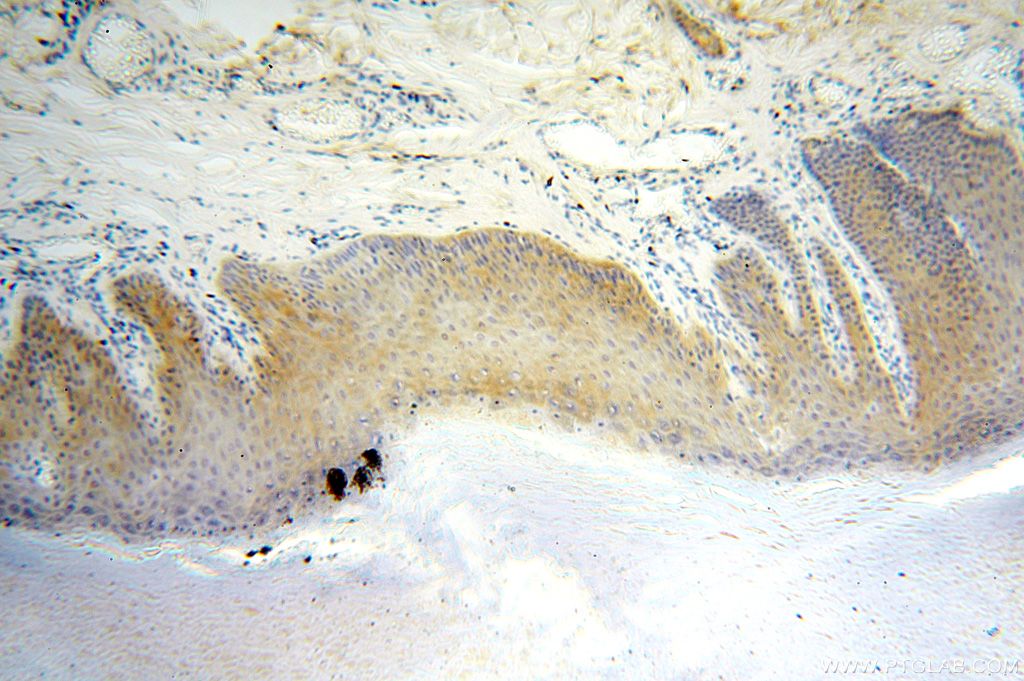 Immunohistochemistry (IHC) staining of human skin tissue using YARS2 Polyclonal antibody (17150-1-AP)