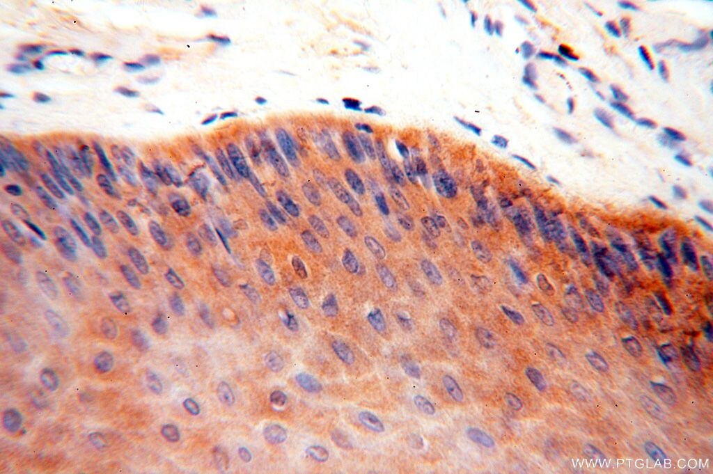 Immunohistochemistry (IHC) staining of human skin tissue using YARS2 Polyclonal antibody (17150-1-AP)