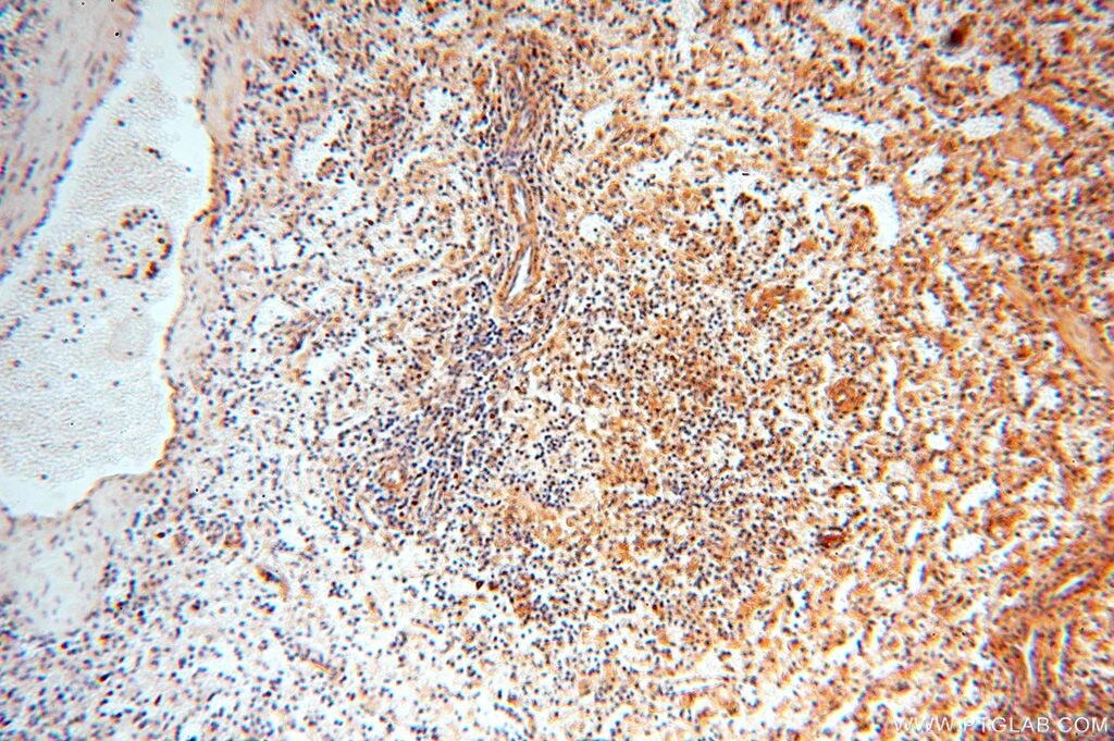 Immunohistochemistry (IHC) staining of human spleen tissue using YARS2 Polyclonal antibody (17150-1-AP)