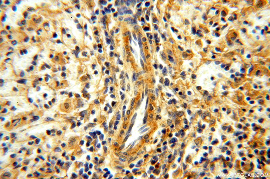 Immunohistochemistry (IHC) staining of human spleen tissue using YARS2 Polyclonal antibody (17150-1-AP)