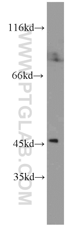 WB analysis of K-562 using 17150-1-AP