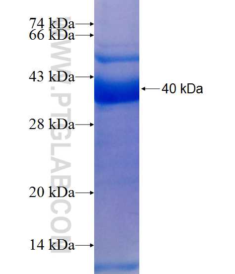 YARS2 fusion protein Ag9506 SDS-PAGE
