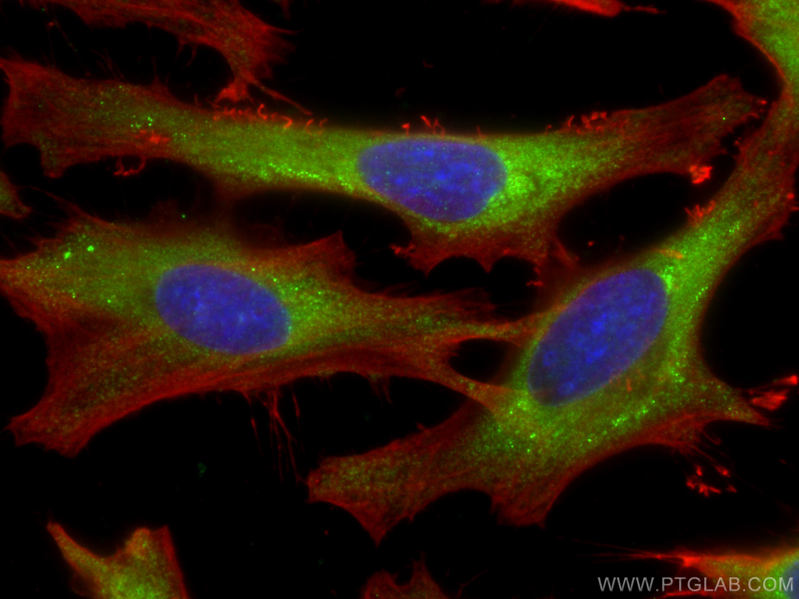 Immunofluorescence (IF) / fluorescent staining of HeLa cells using YBX1 Polyclonal antibody (20339-1-AP)