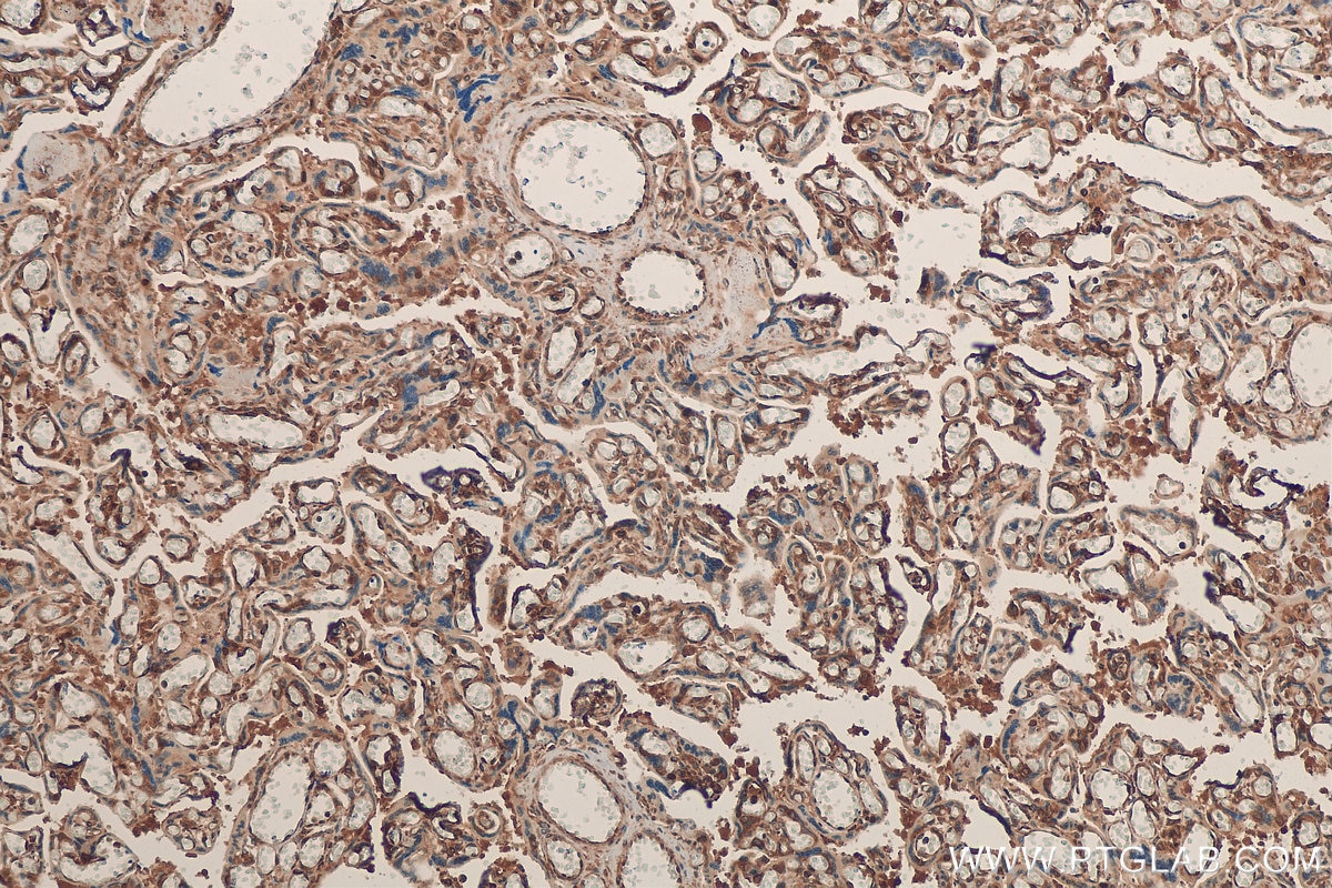 Immunohistochemistry (IHC) staining of human placenta tissue using YBX1 Polyclonal antibody (20339-1-AP)