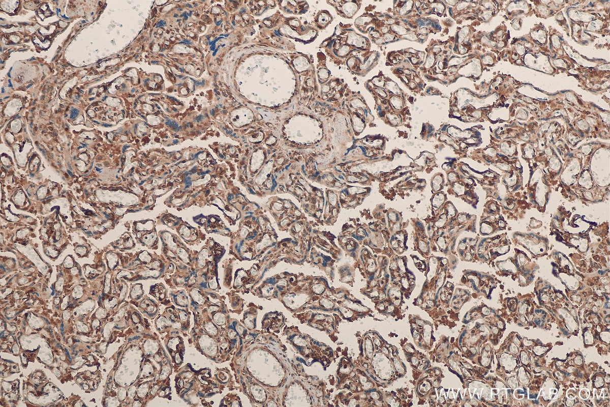 IHC staining of human placenta using 20339-1-AP