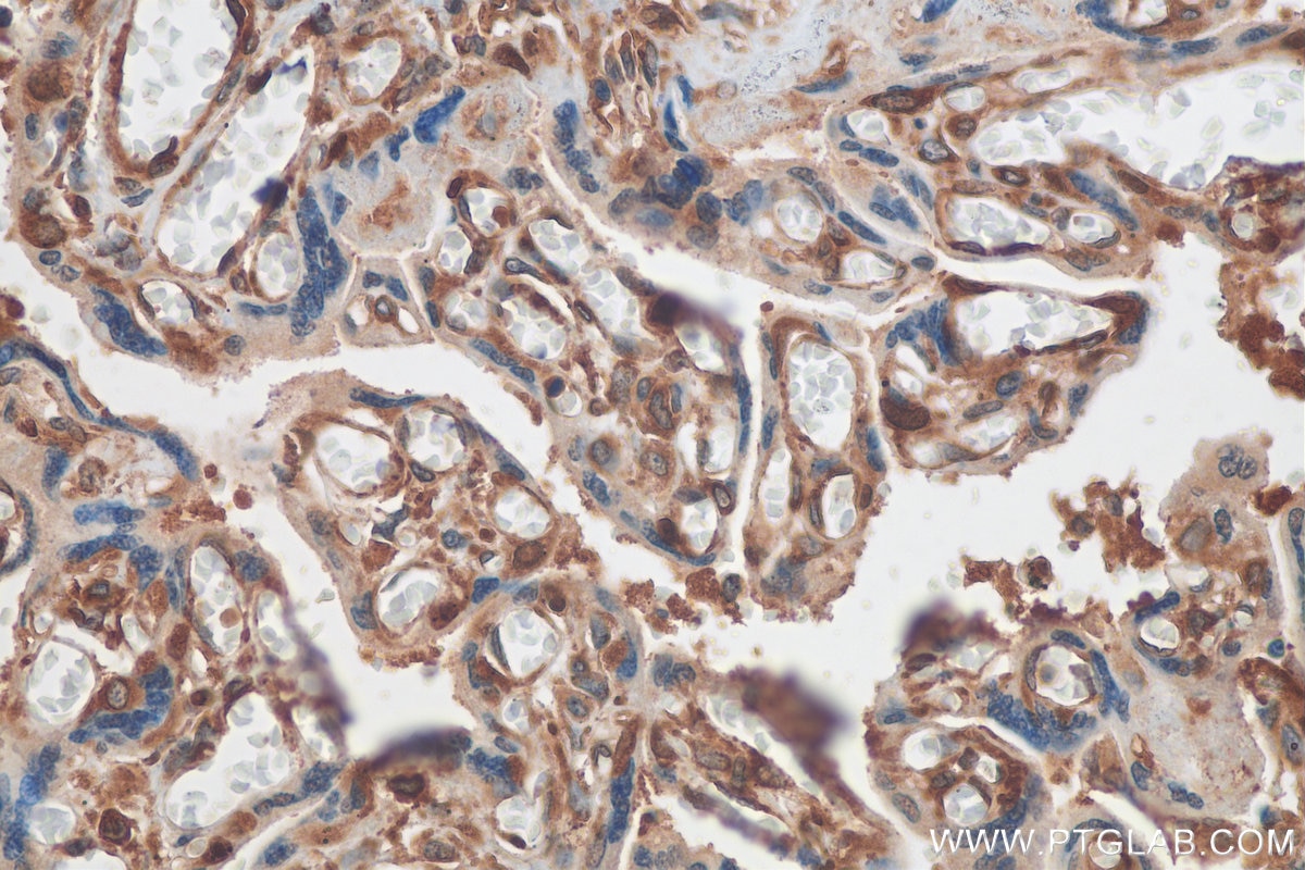 Immunohistochemistry (IHC) staining of human placenta tissue using YBX1 Polyclonal antibody (20339-1-AP)