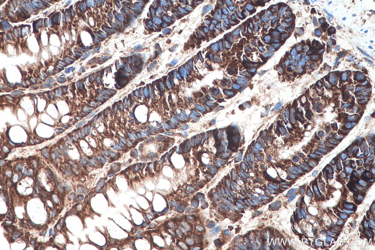 Immunohistochemistry (IHC) staining of mouse colon tissue using YBX1 Polyclonal antibody (20339-1-AP)