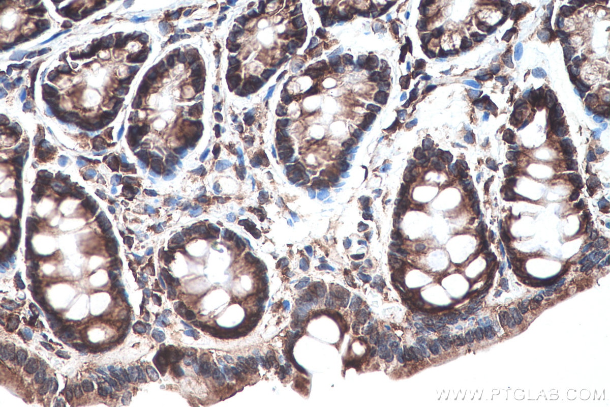 Immunohistochemistry (IHC) staining of rat colon tissue using YBX1 Polyclonal antibody (20339-1-AP)