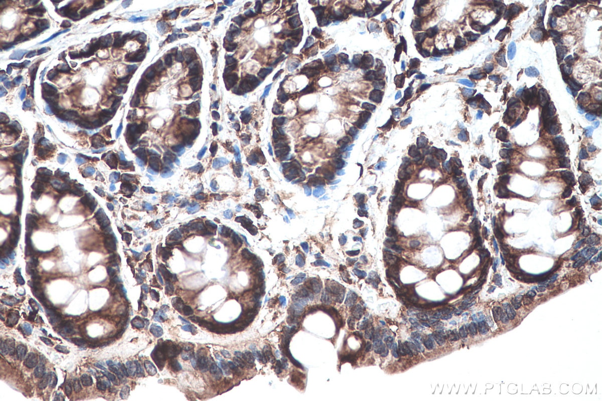 Immunohistochemistry (IHC) staining of rat colon tissue using YBX1 Polyclonal antibody (20339-1-AP)