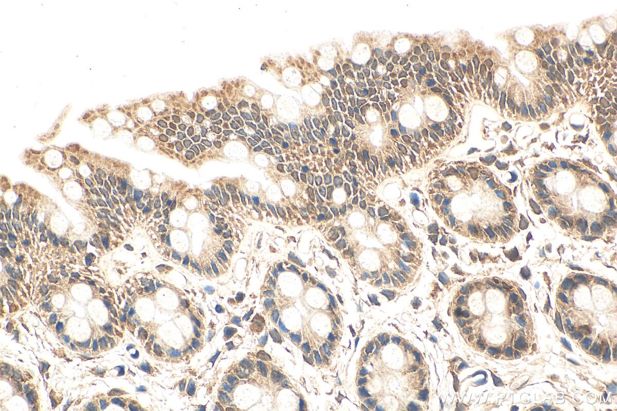 IHC staining of rat colon using 20339-1-AP