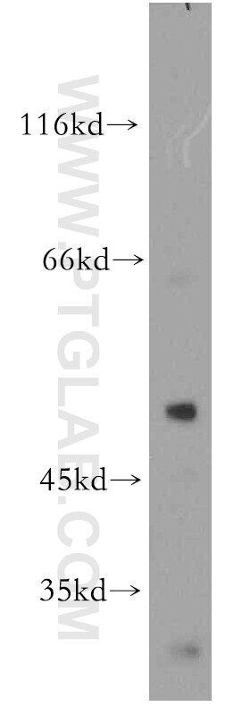 YBX1 Polyclonal antibody