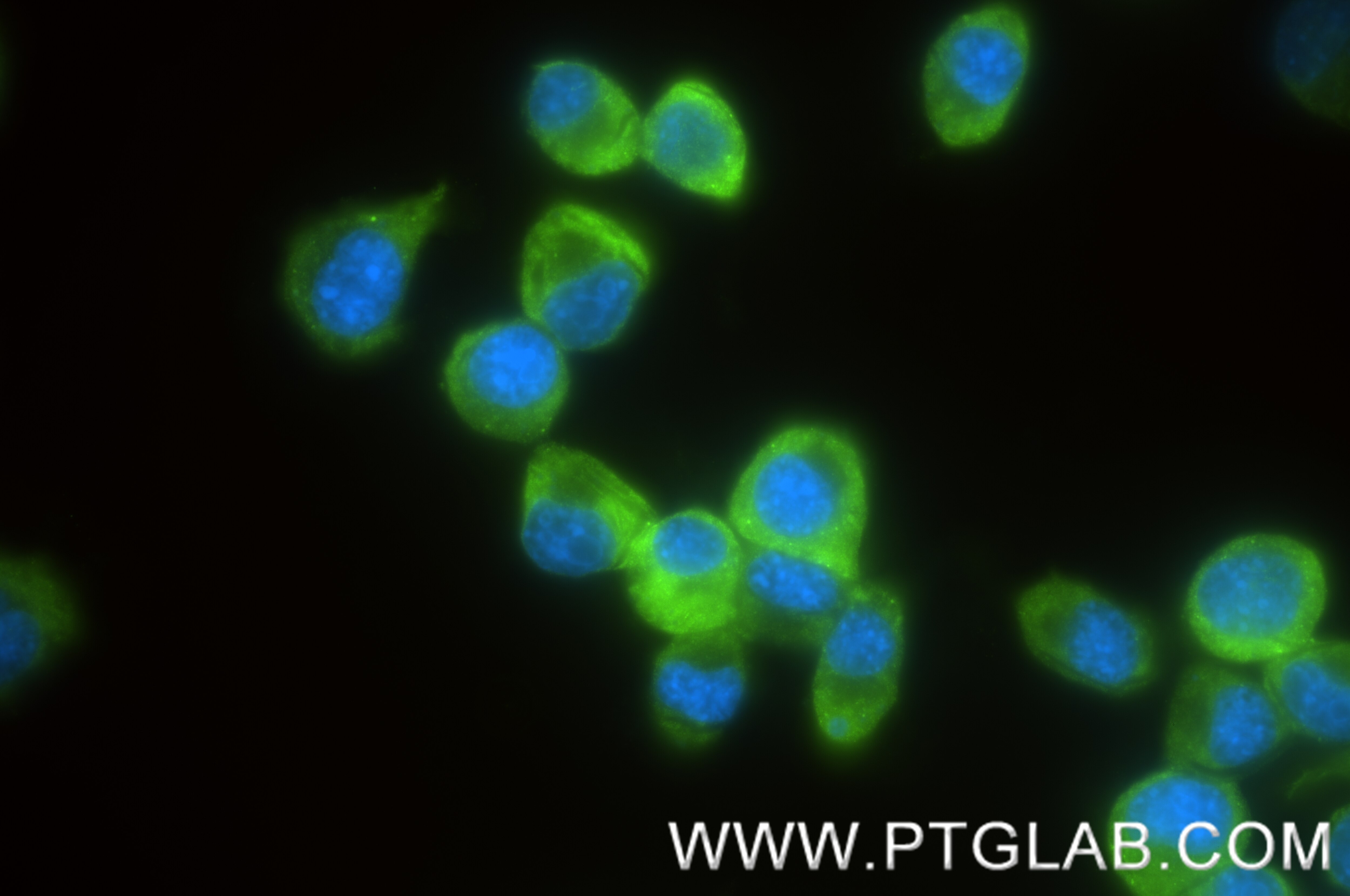 Immunofluorescence (IF) / fluorescent staining of Neuro-2a cells using YBX1 Recombinant antibody (84993-4-RR)