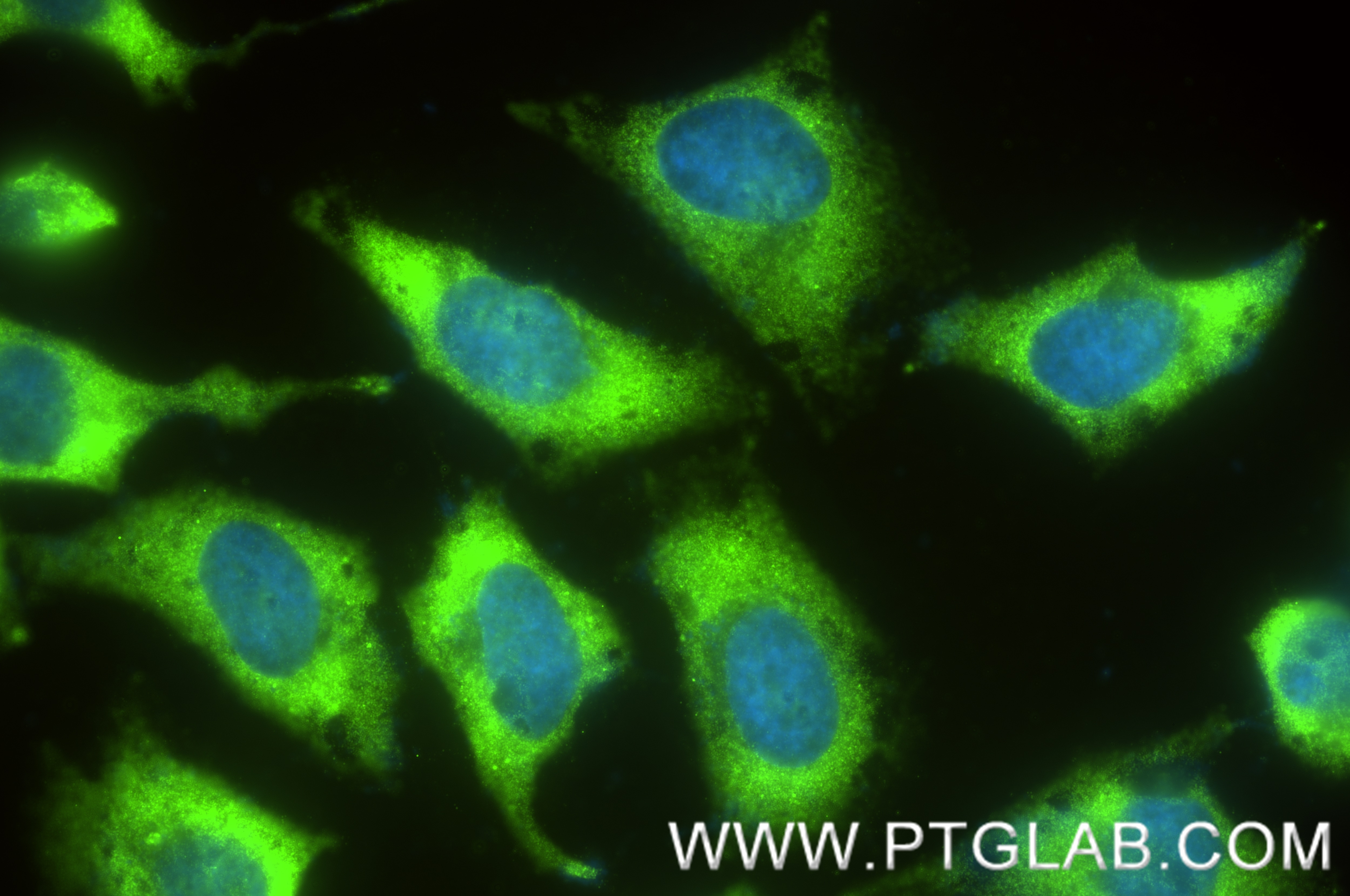 Immunofluorescence (IF) / fluorescent staining of HeLa cells using YBX1 Recombinant antibody (84993-4-RR)