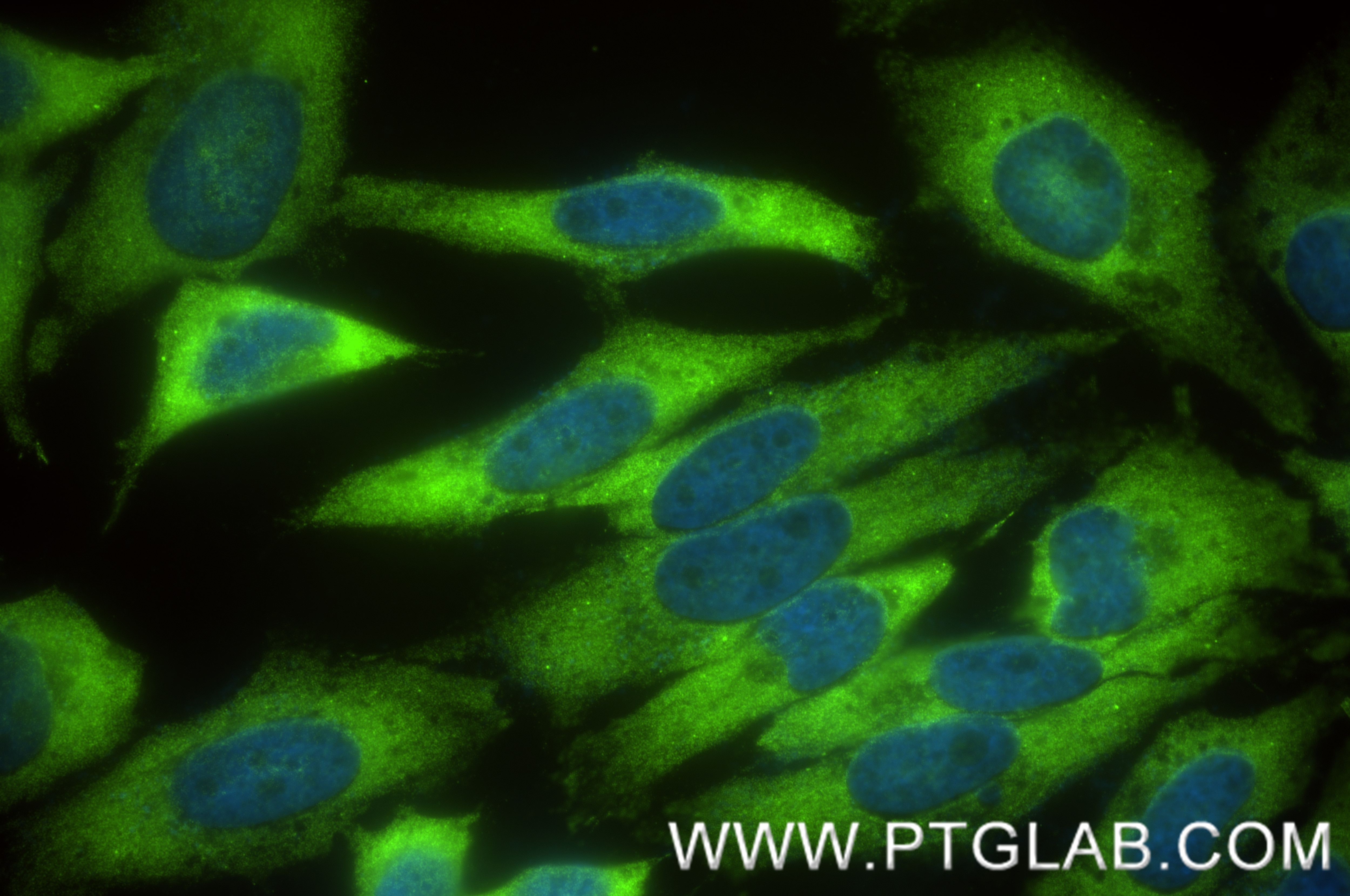 Immunofluorescence (IF) / fluorescent staining of HeLa cells using YBX1 Recombinant antibody (84993-4-RR)