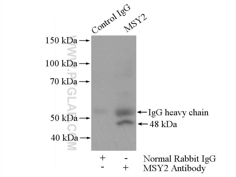 IP experiment of PC-3 using 13538-1-AP